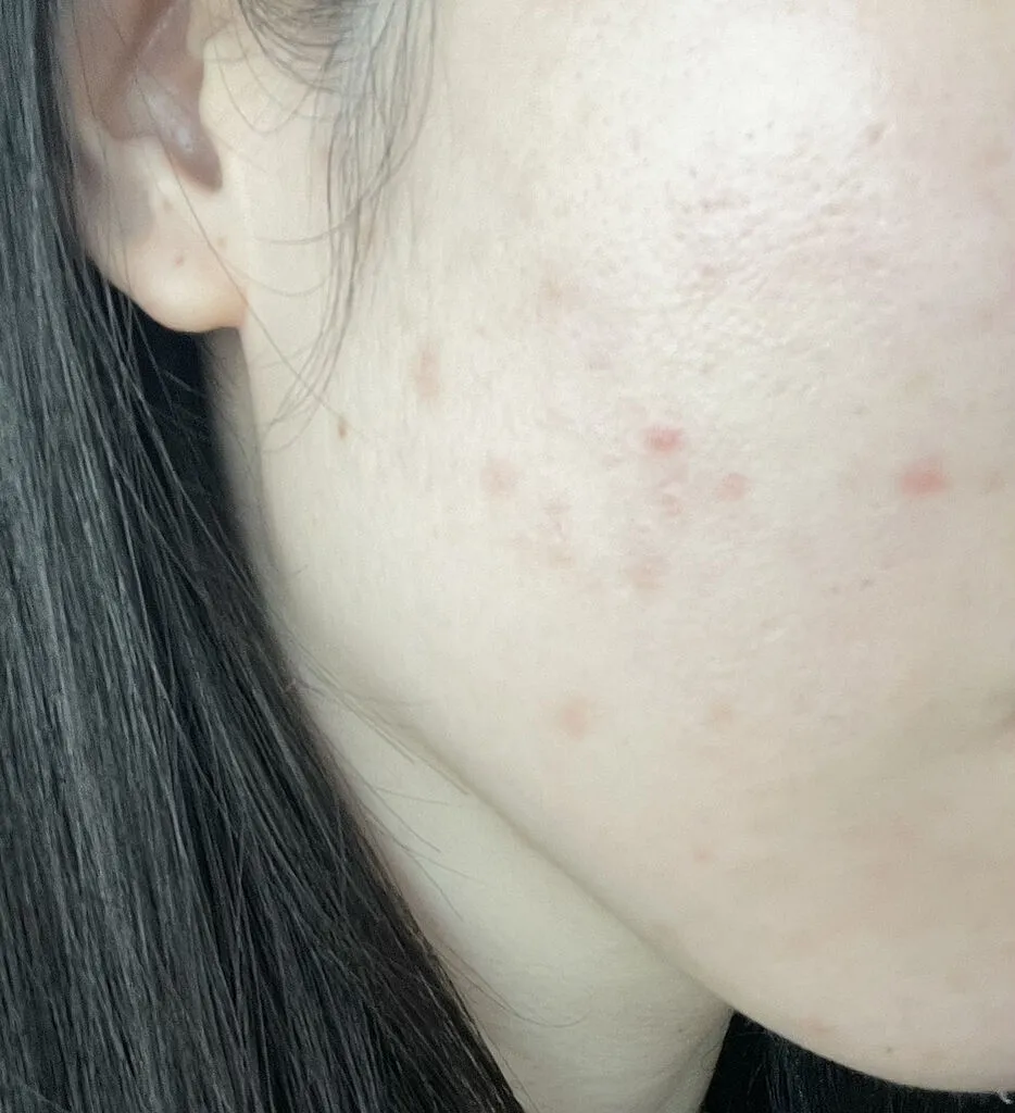 Mediheal Madecassoside Blemish Repair sérum 40 ml anti-imperfections