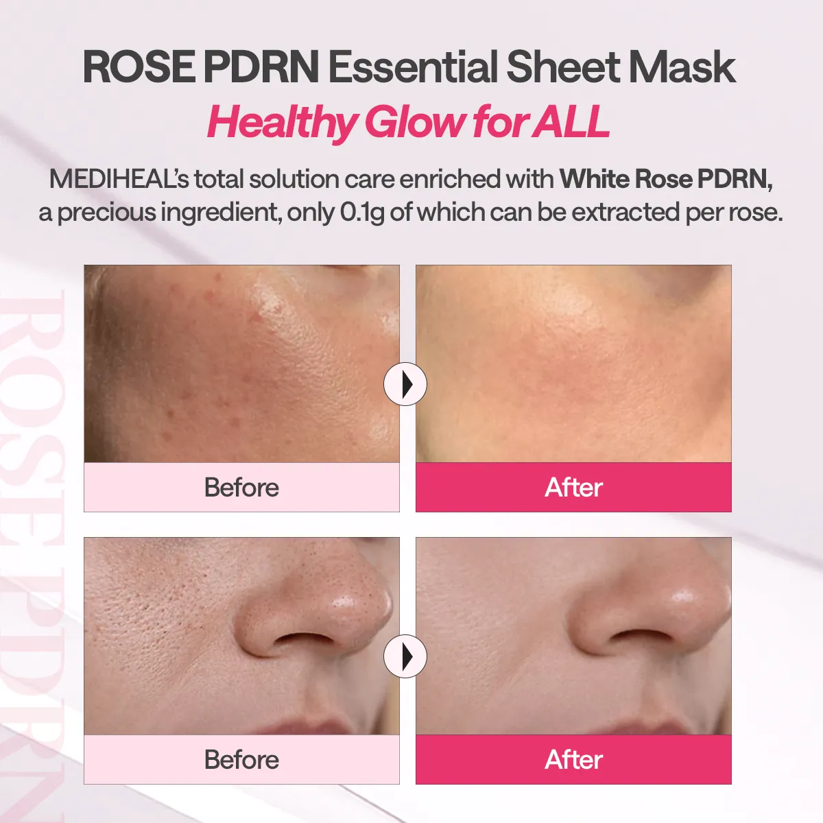 Mediheal Rose PDRN Essential Mask masque tissu 10 pcs eclat