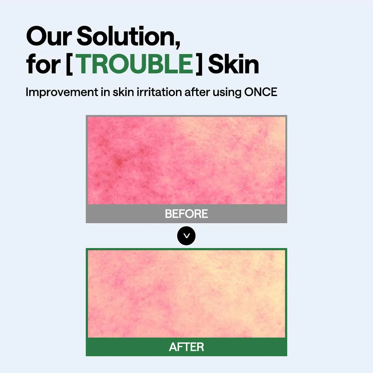 Mediheal Teatree masque wrapping apaisant x10 pureté