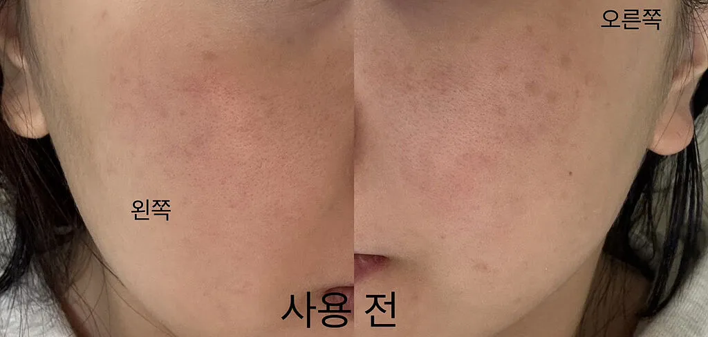 Mediheal Madecassoside Blemish Repair sérum 40 ml anti-imperfections