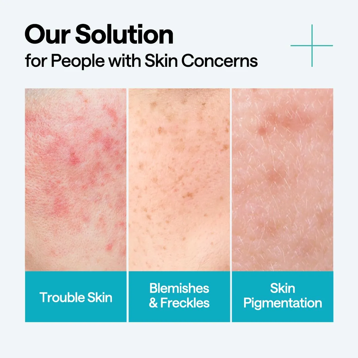 Mediheal Madecassoside Blemish Repair sérum 40 ml anti-imperfections