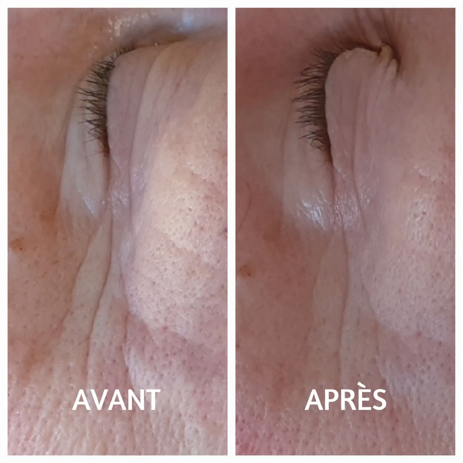 Les Poulettes Patchs Yeux contour intégral anti-cernes hydratant