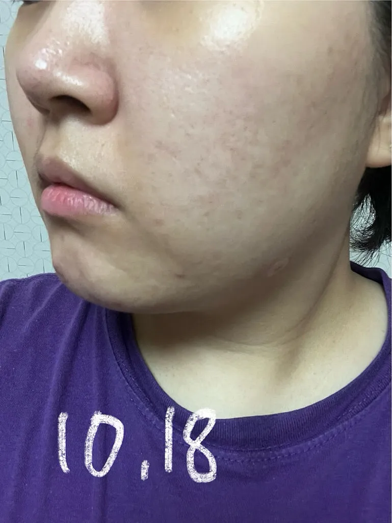 Mediheal Madecassoside Essential Mask tissu 10 masques