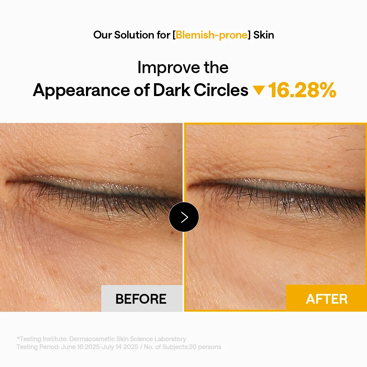 Mediheal Vitamin C Capsule patch yeux éclat