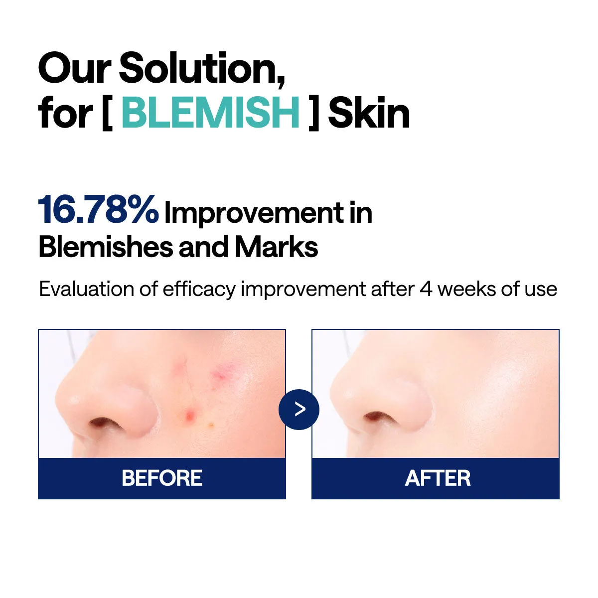 Mediheal Madecassoside Pad toner 100 pads peau sensible