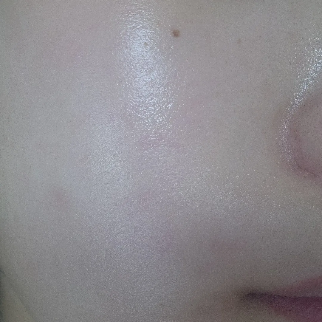 Mediheal Madecassoside Blemish Repair sérum 40 ml anti-imperfections