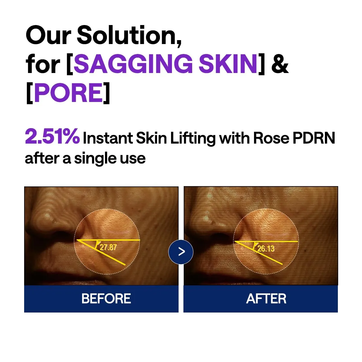 Mediheal PDRN Lifting Sérum 40 ml raffermissant