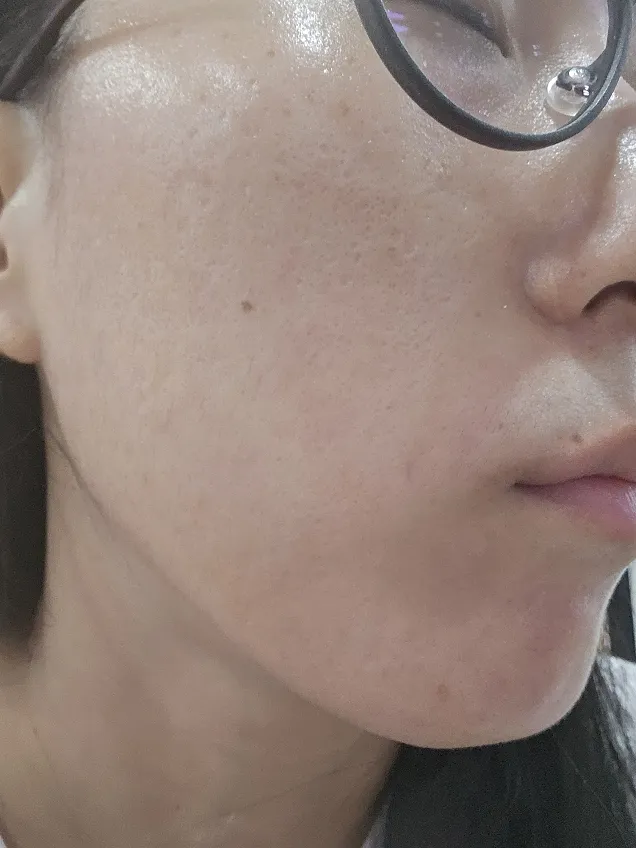 Mediheal Vitamin C Essential masque visage teint lumineux vitamine C