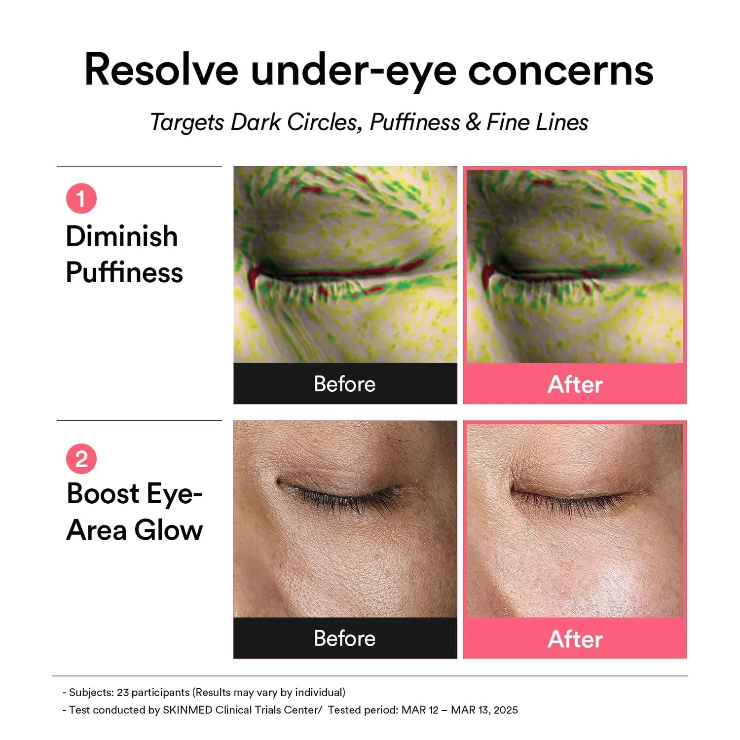 Abib PDRN Glow Jelly Patch Yeux 60 Rétinol Poches