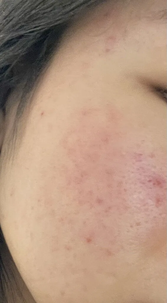 Mediheal Vitamin C sérum éclat 40 ml anti-taches