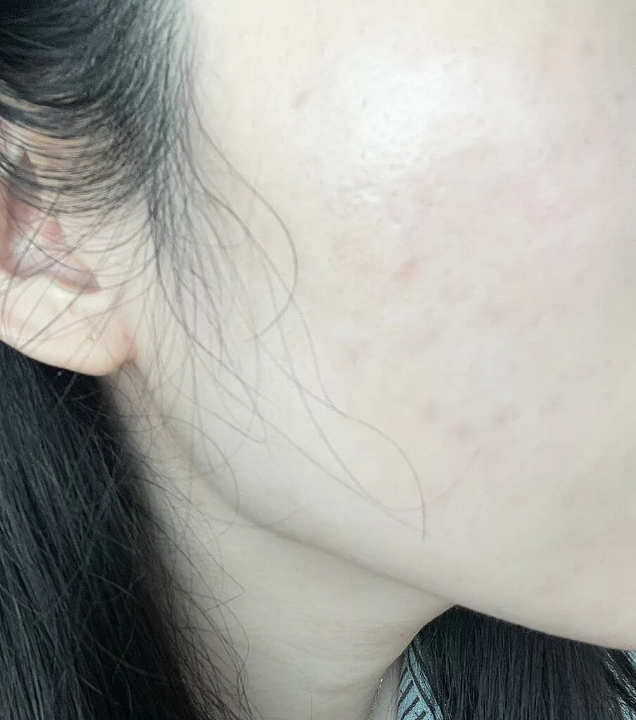 Mediheal Madecassoside Blemish Repair sérum 40 ml anti-imperfections