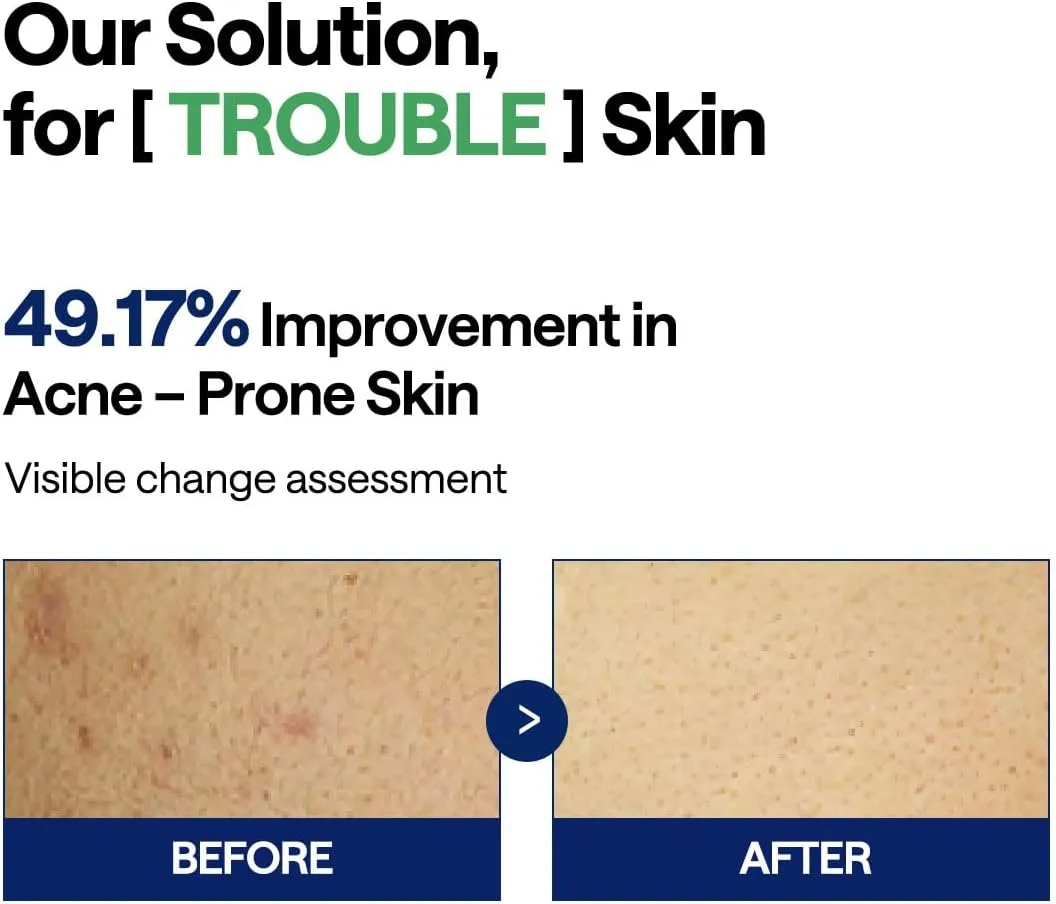 Mediheal Teatree Trouble Pad toner 100 pads peau grasse