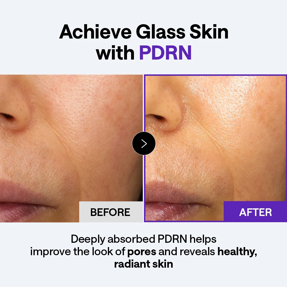 Mediheal Derma Cream PDRN crème 50 ml fermeté