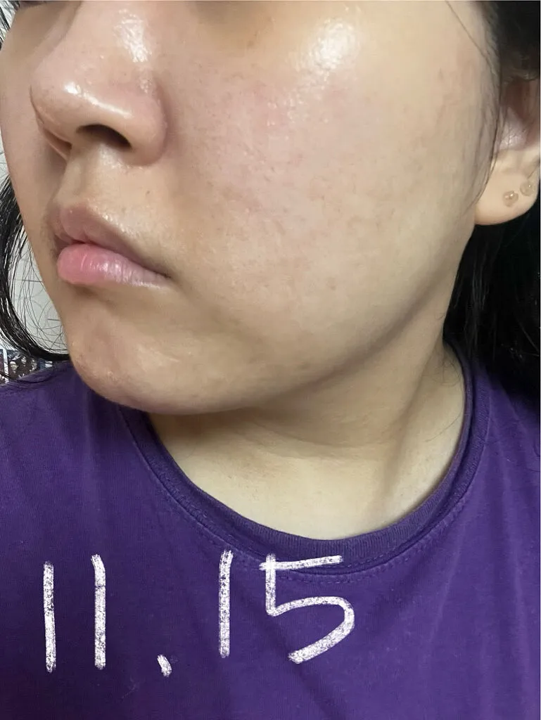 Mediheal Madecassoside Essential Mask tissu 10 masques