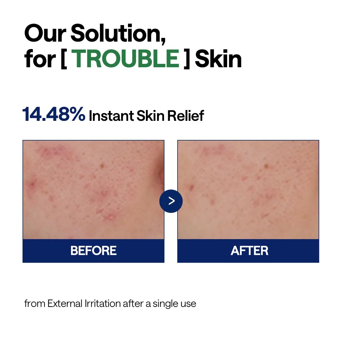 Mediheal Teatree Calming Hydra Sérum 40 ml peau grasse