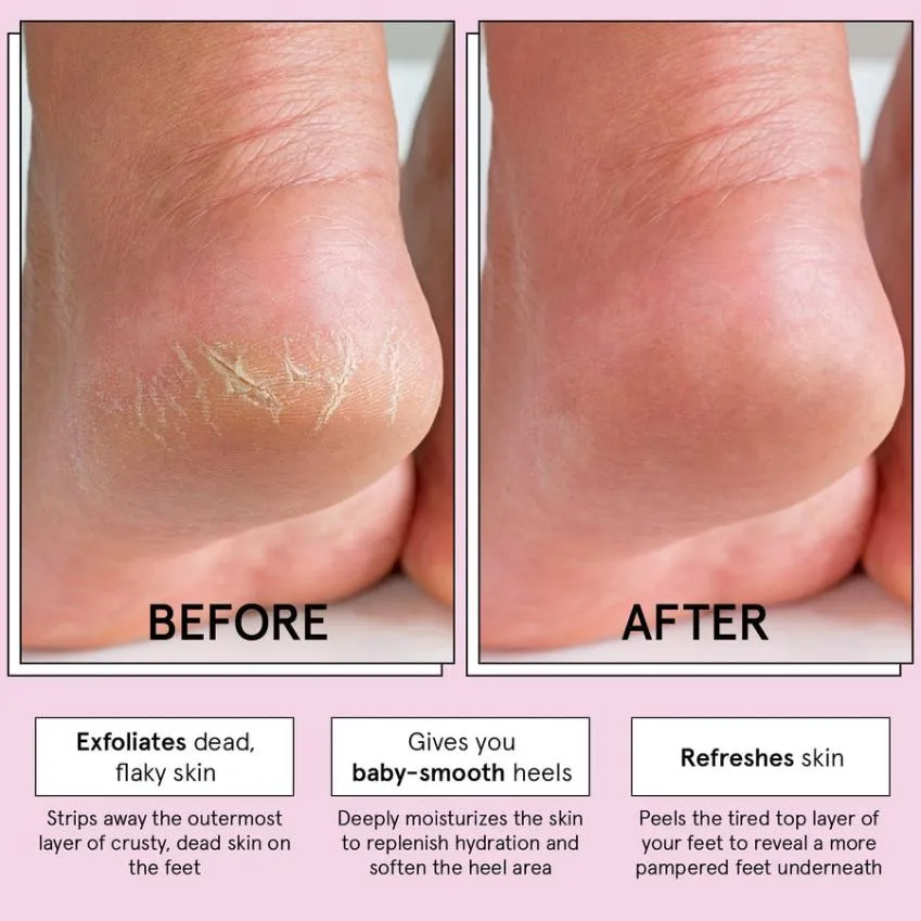 Grace & Stella Foot Peel masque pieds Original 2 paires