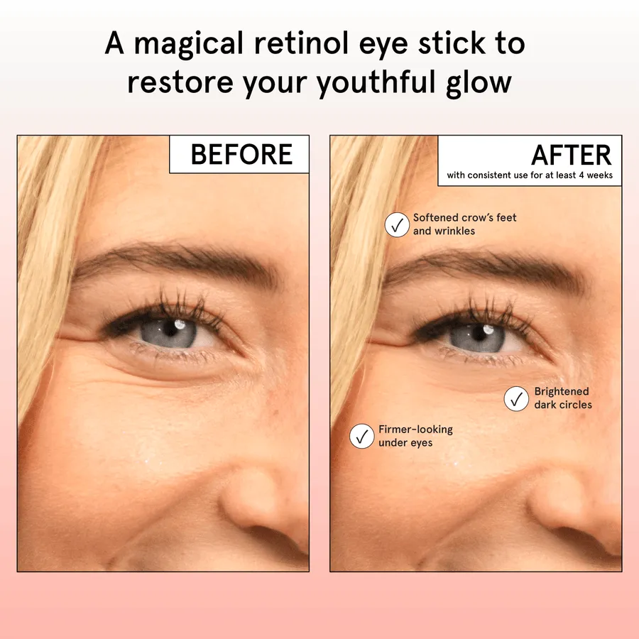 Grace & Stella Baume contour yeux stick rétinol caféine