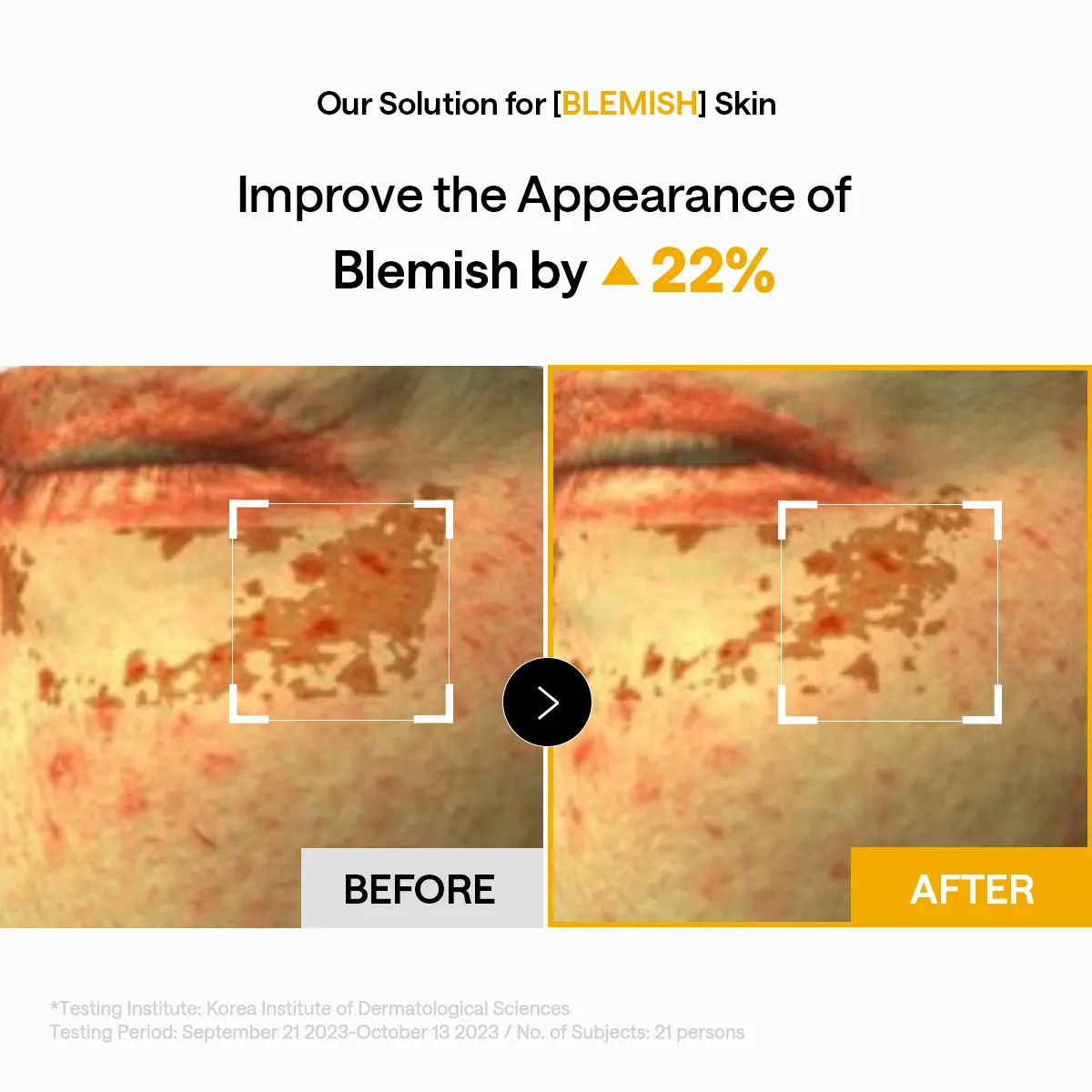 Mediheal Vita Collagen patch yeux 60 patchs fermeté