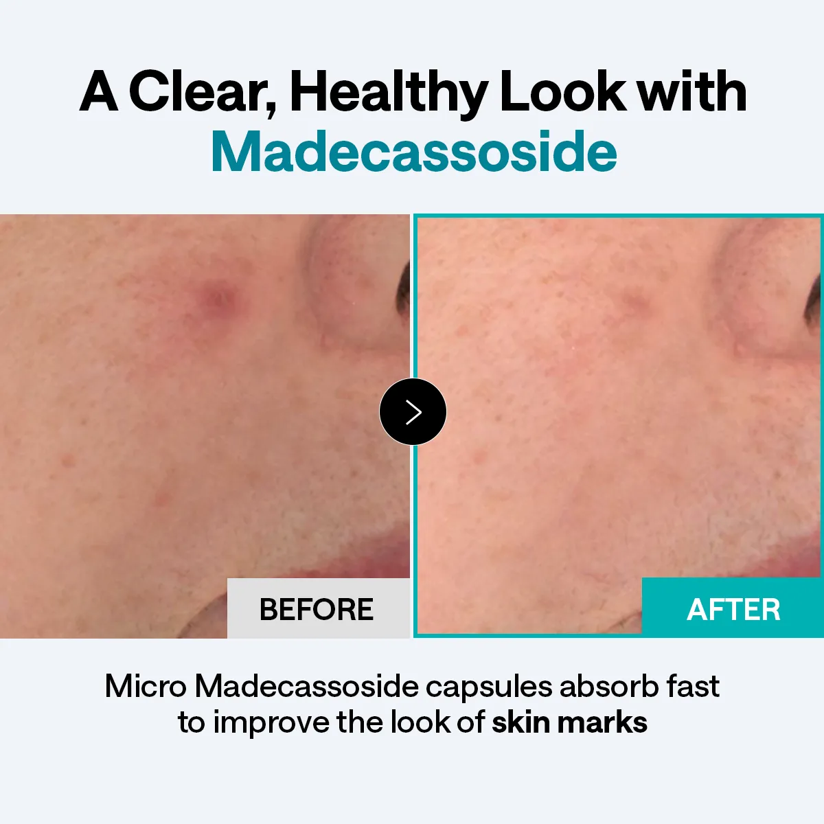Mediheal Derma Cream Madecassoside crème 50 ml taches